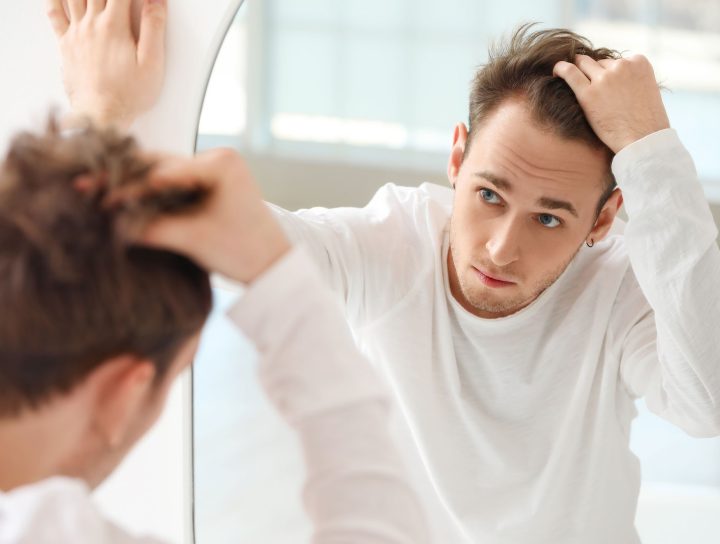 Hair transplant in Bandra