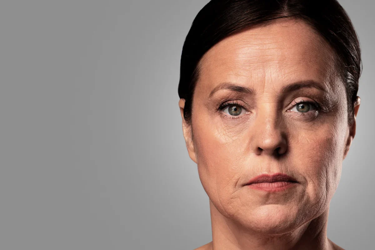 Wrinkle treatment in Bandra