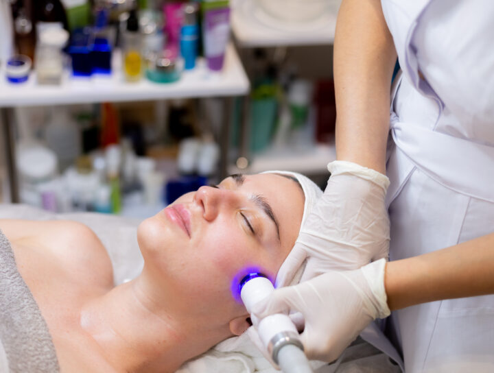 laser treatment for acne scars