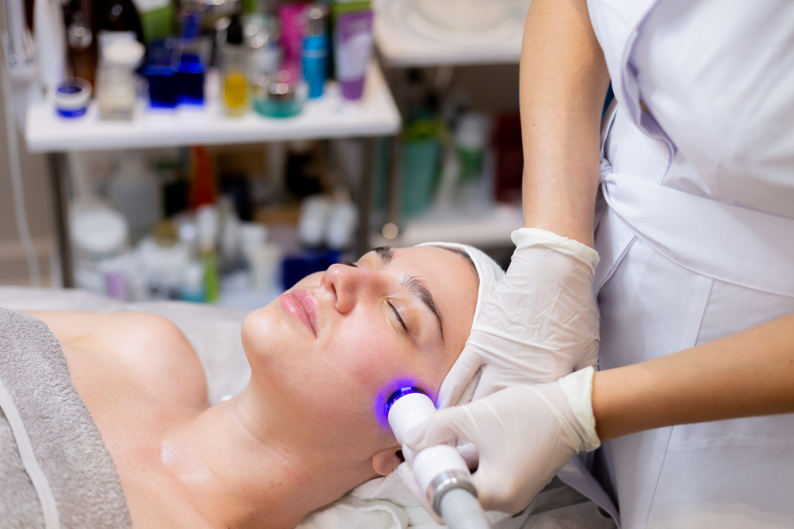 laser treatment for acne scars